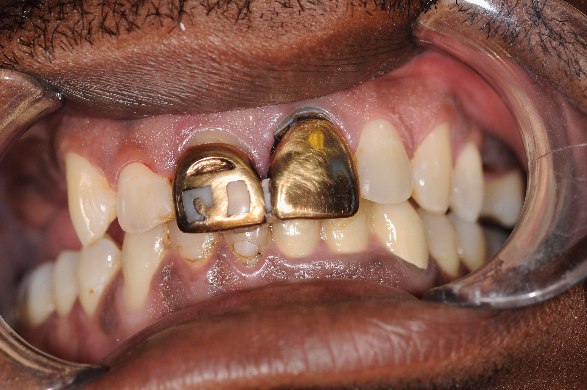 Dentist Plant City
