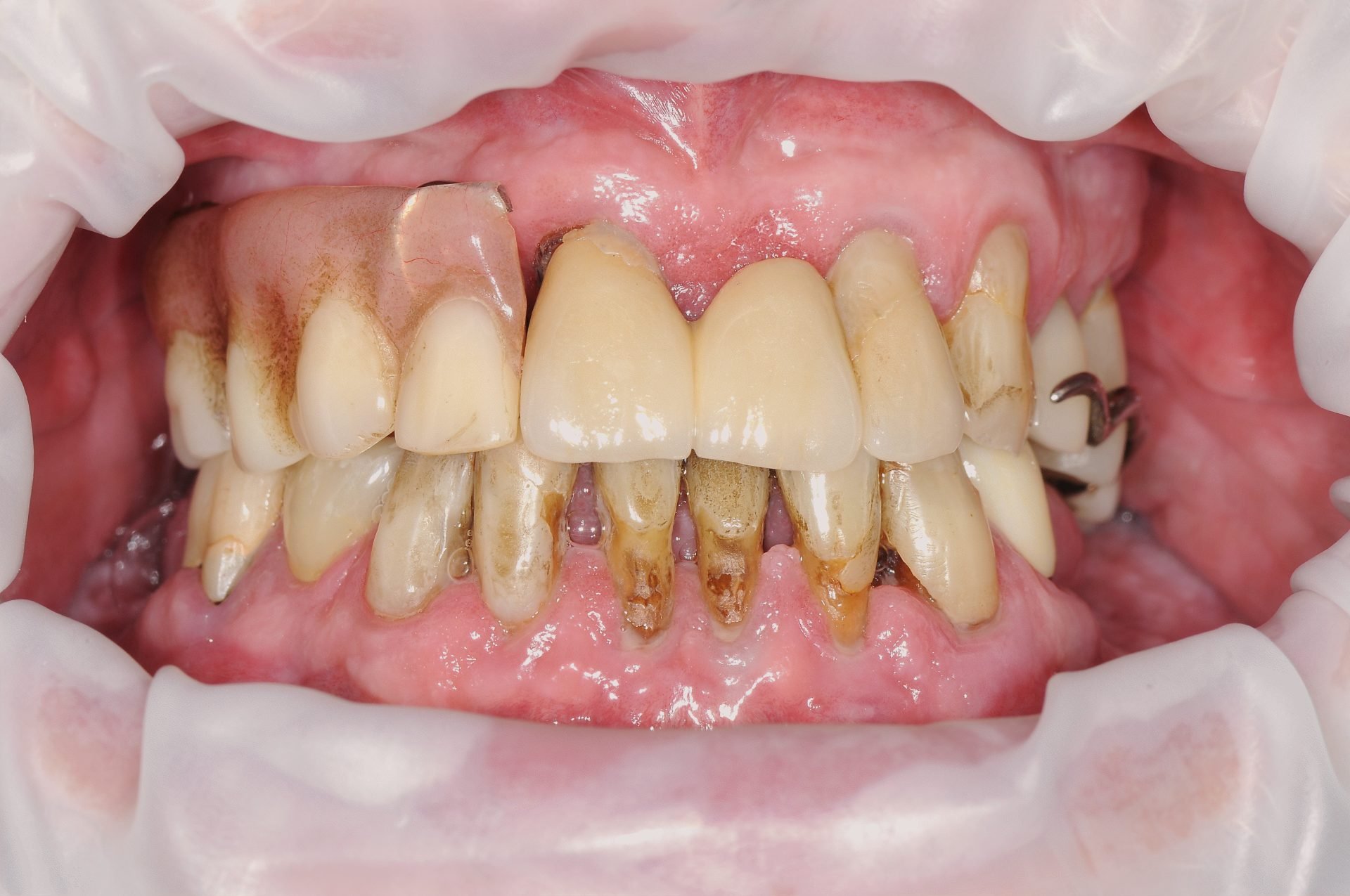 Dentist Plant City