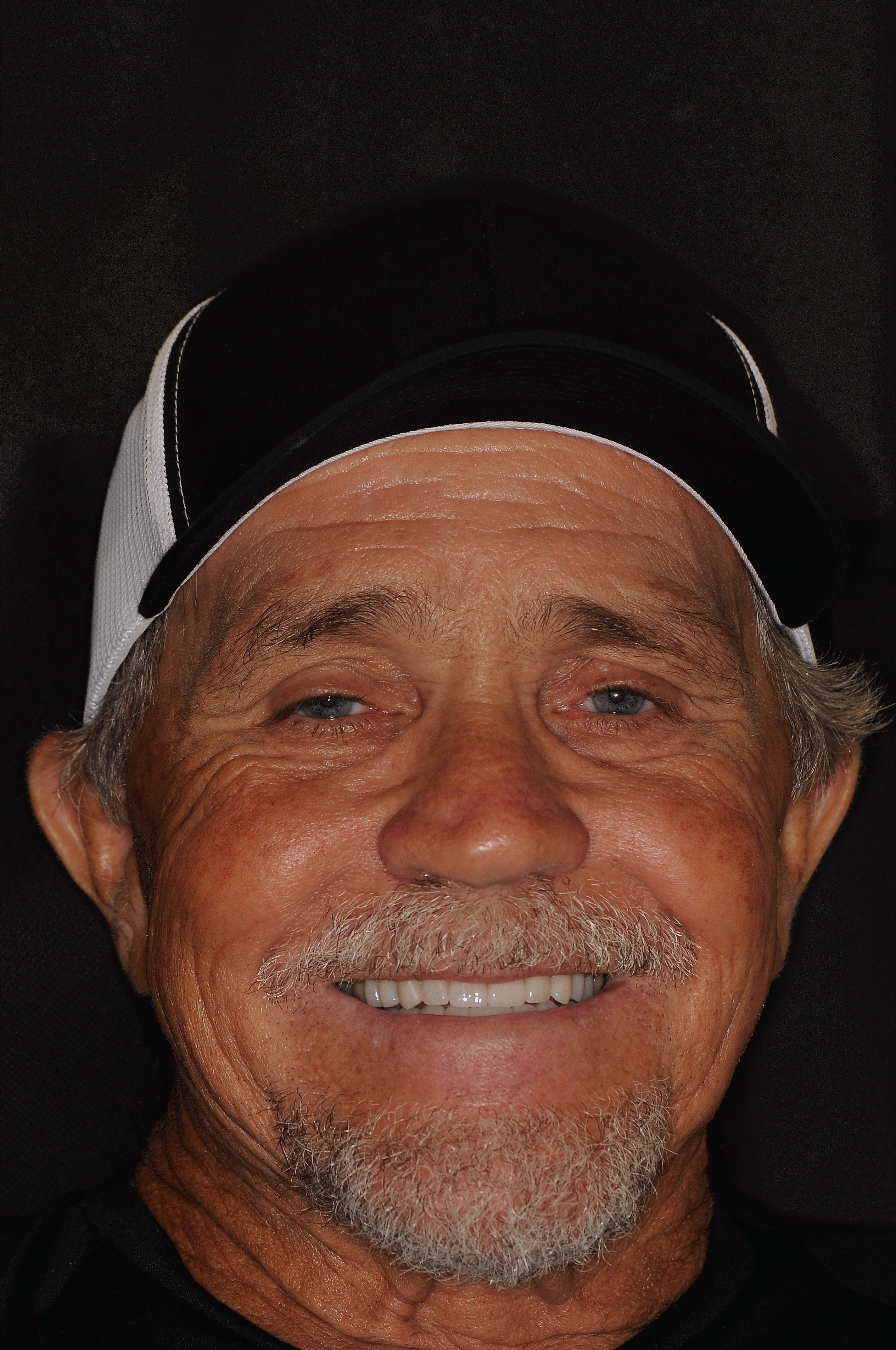 Patient with restored full smile after treatment at Dentist Plant City