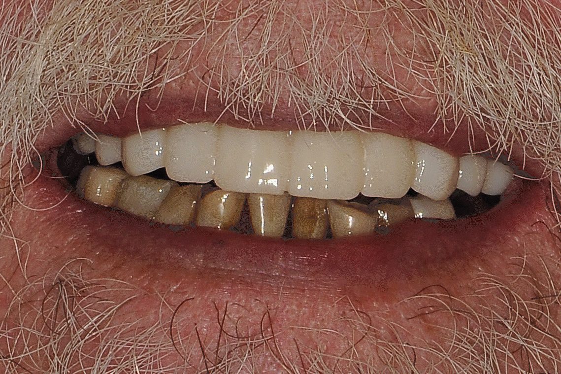 Dentist Plant City
